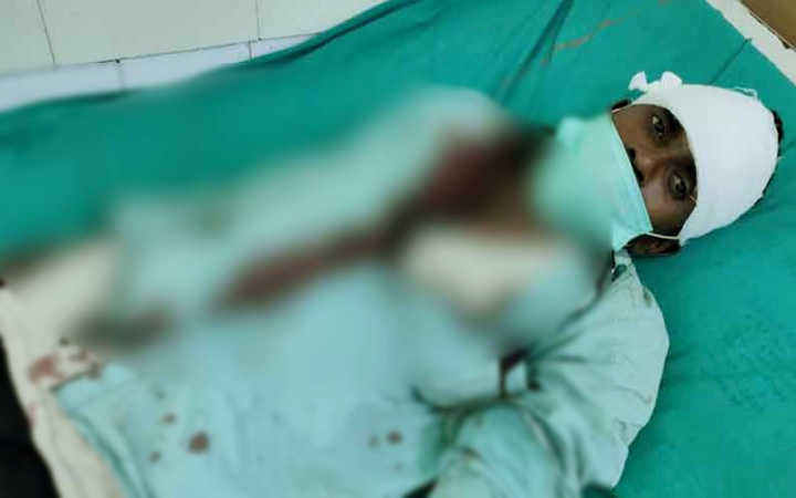 attacked on bjp worker in dhupguri